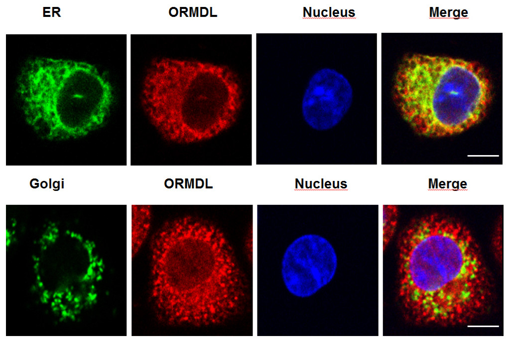 Fig. 1. Colocalization of endogenous ORMDL proteins (shown in red) with a marker of endoplasmic reticulum (ER, upper panel, in green) but not with a marker of another cell compartment, Golgi apparatus (lower panel; in green) in murine mast cells. Nuclei (shown in blue) and merged pictures are also shown; bars, 5 µm.