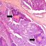 AoS. Rabbits with mammary carcinomas as a model for comparative pathology and translational science in breast cancer research